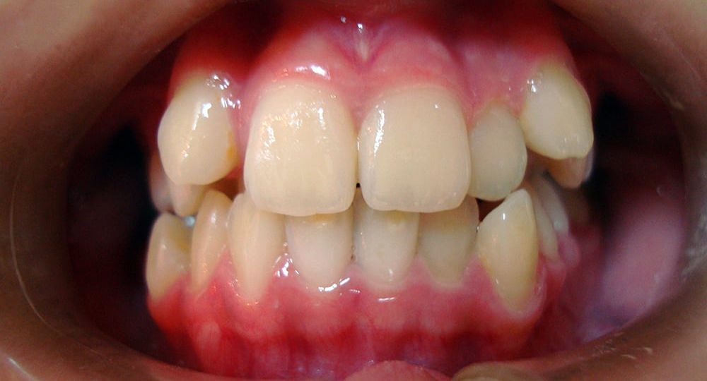 Orthodontis1-1