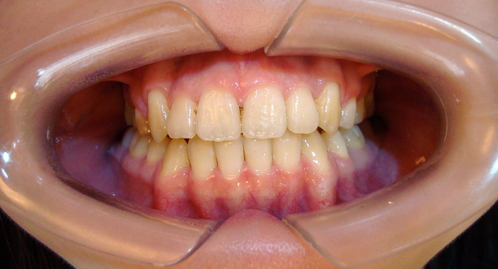 Orthodontis12-2