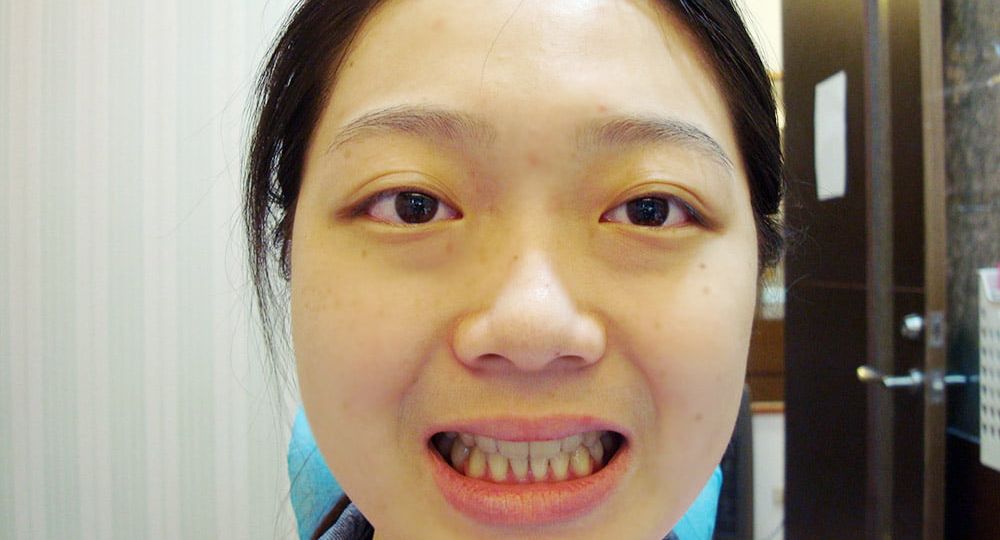 Orthodontis13-4