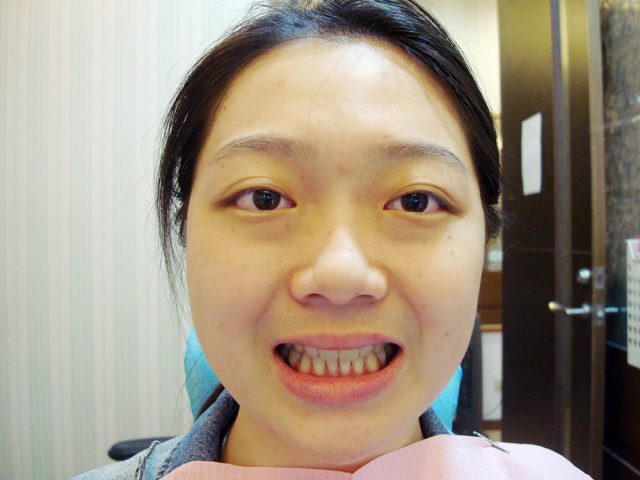 Orthodontis13-4