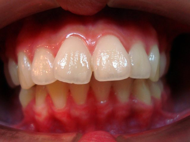 Orthodontis2-1