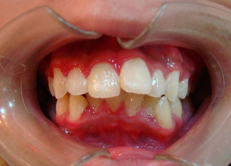 Orthodontis4-1