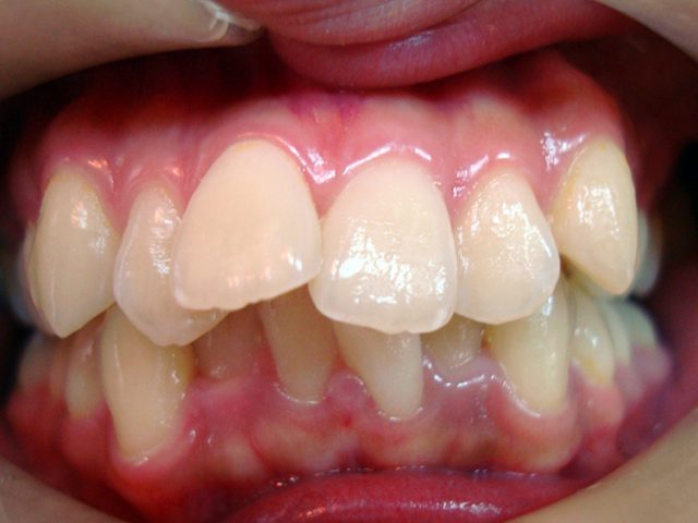 Orthodontis5-1