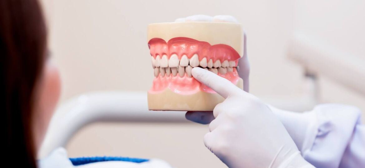 implant-dentistry-teeth-healthcare-concept-